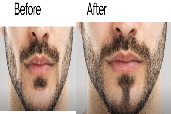 Add facial hair Before