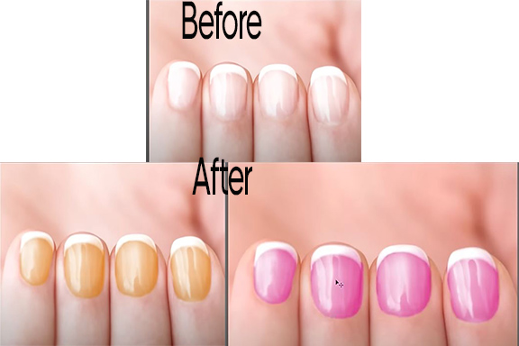 Color nail polish Before