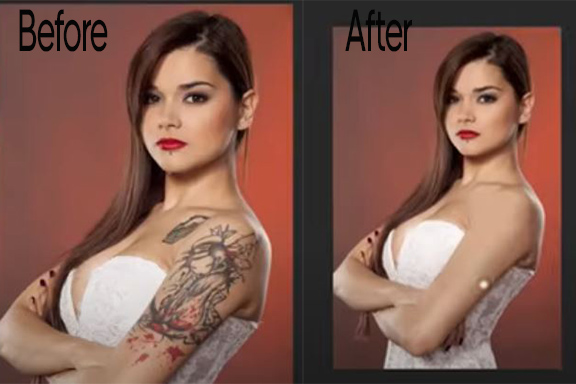 Remove tattoo Before