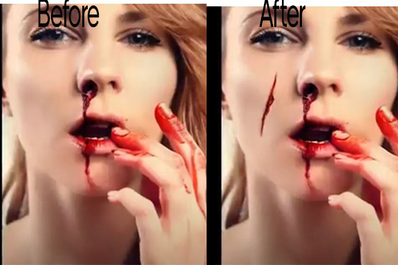 Add a scar Before